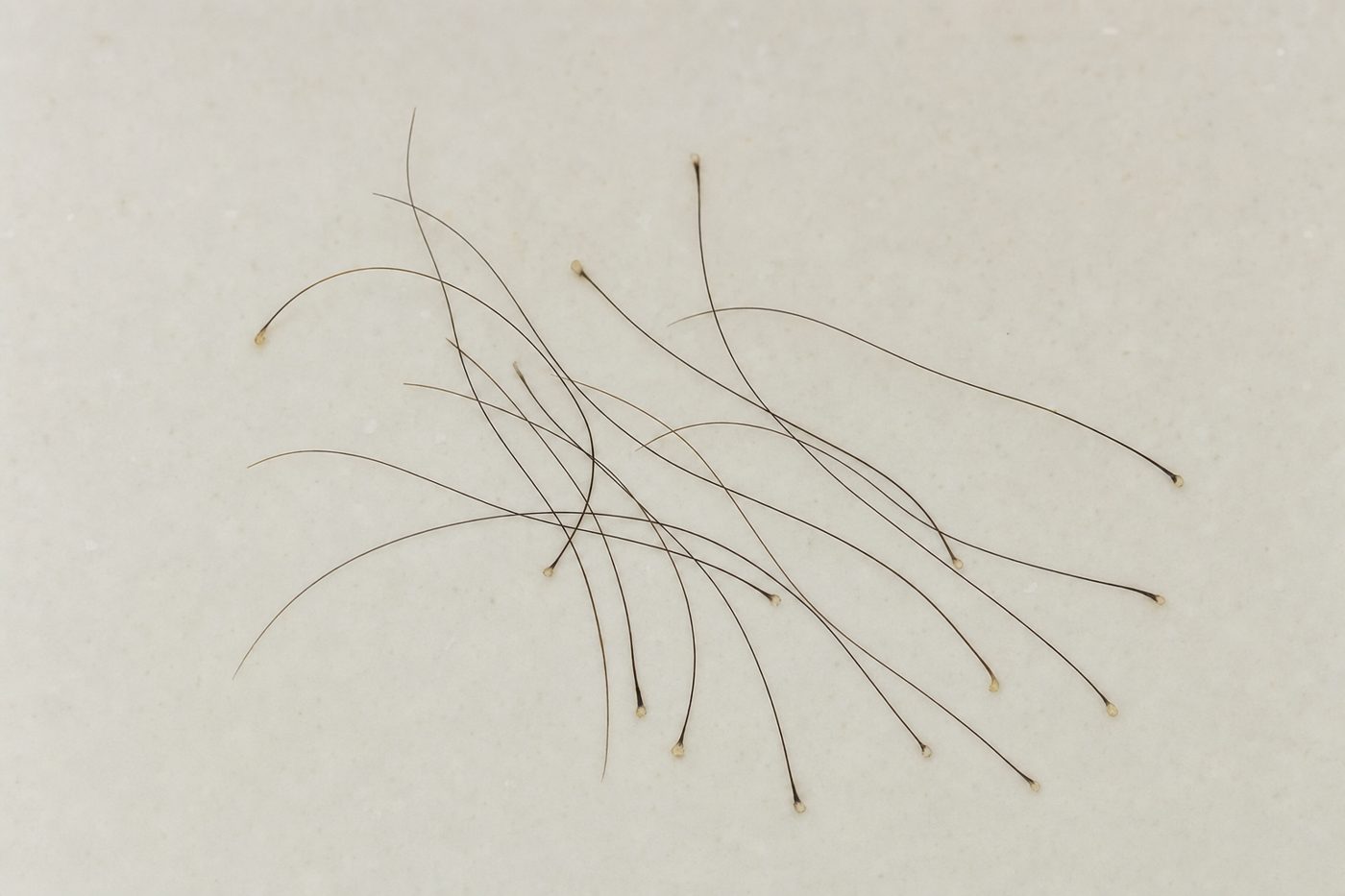 Illustrative photo of shed hair strands collected on a pale bathroom surface